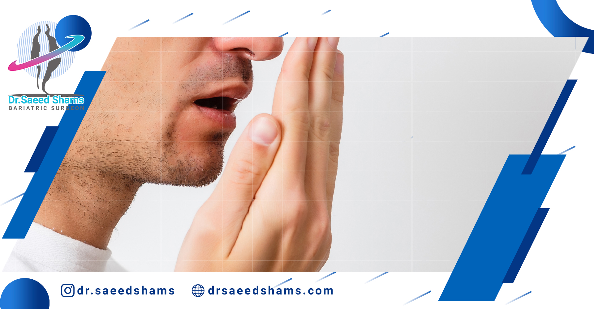 علت بوی بد دهان بعد از جراحی چاقی چیست؟