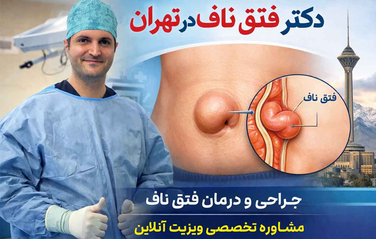 دکتر فتق ناف در تهران