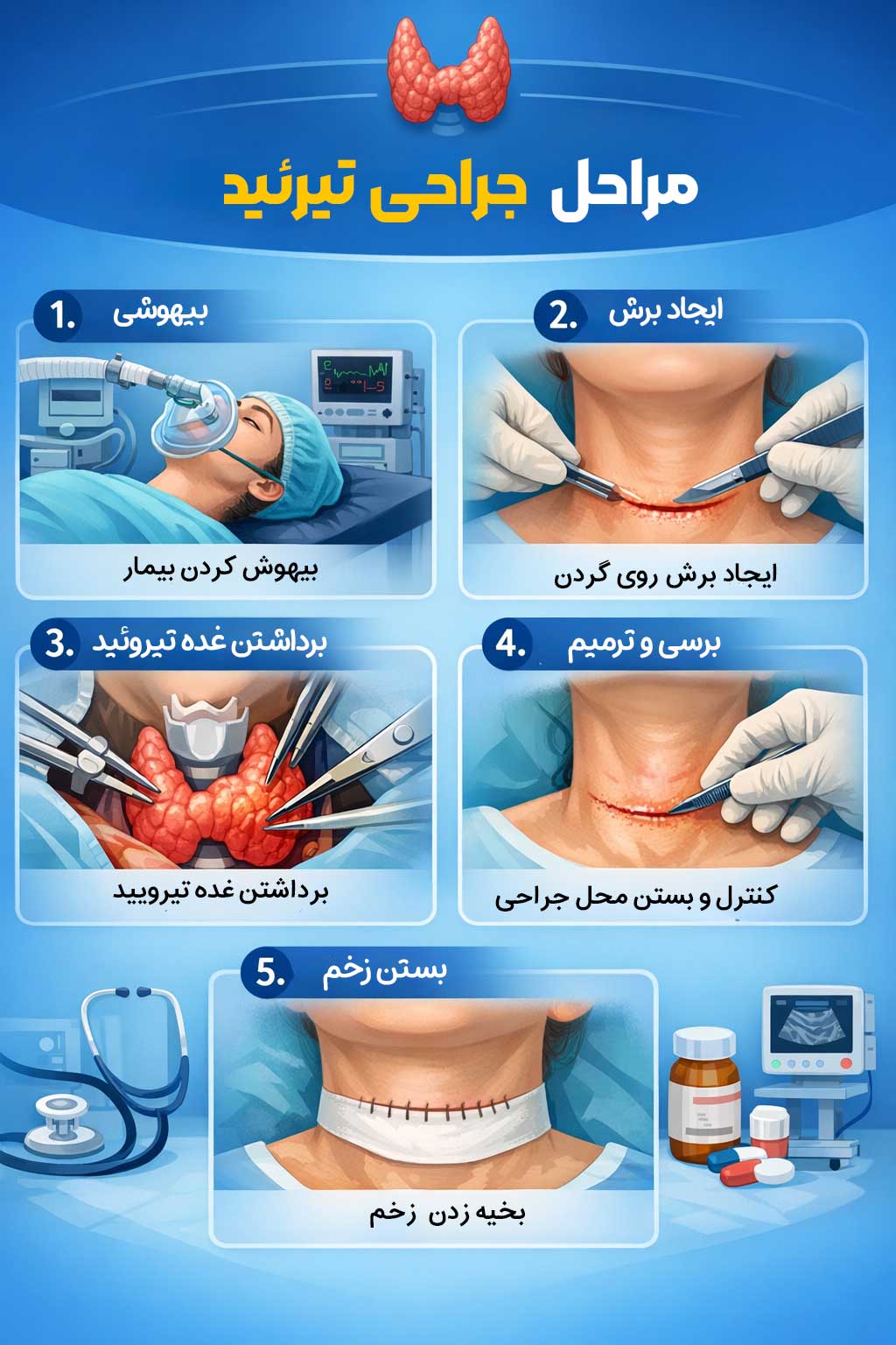 مراحل جراحی تیروئيد